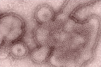 The H3N2 flu virus, one of many that have caused misery in the US and beyond.