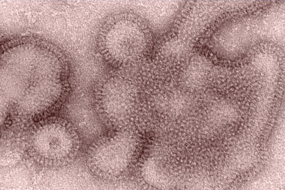 The H3N2 flu virus, one of many that have caused misery in the US and beyond.