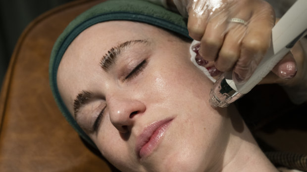 What I wish I knew about microneedling before trying it for myself