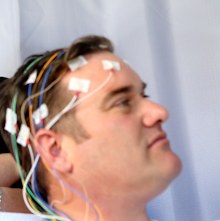 Cochlear-backed medtech Epiminder seeks $200m val in pre-IPO raise