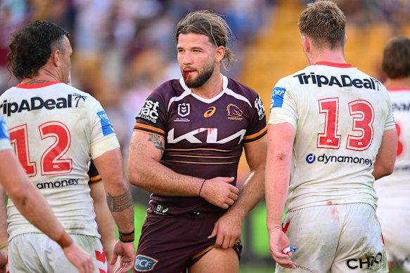 Pat Carrigan suffered a facial laceration in the Brisbane Broncos defeat to the Dragons.