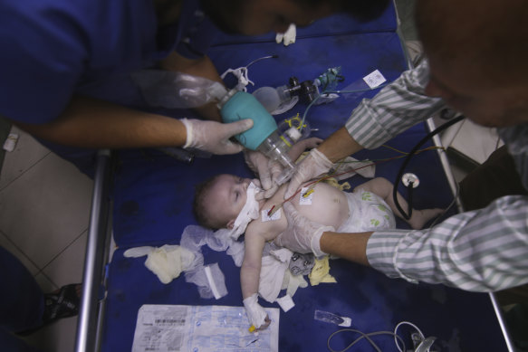 A Palestinian baby wounded in Israeli strikes is treated at Al-Najar hospital in Rafah, Gaza Strip on Friday.