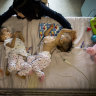 Mum left 'happy' and 'confused' by her conjoined twins separation