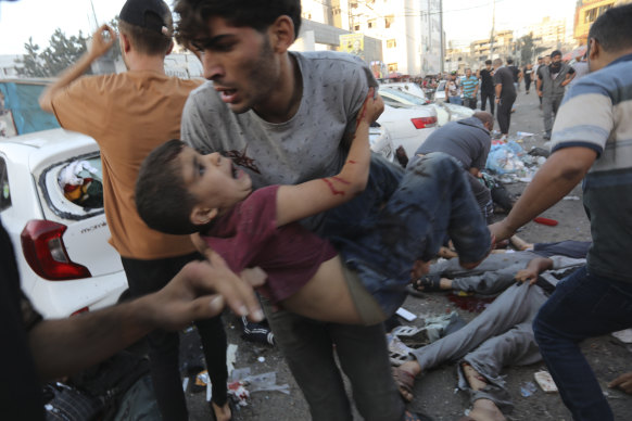 An injured Palestinian boy is carried from the ground following an Israeli airstrike outside the entrance of the al-Shifa hospital in Gaza City.