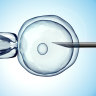 The costly IVF technique being unnecessarily sold to thousands