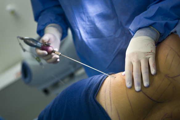 The HCCC is concerned that “non-registered staff” at the clinic were allegedly performing invasive surgical procedures such as breast augmentation without a medical practitioner present. 