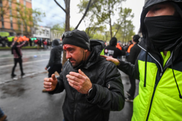 A man is seen with a wound to his forehead on Monday