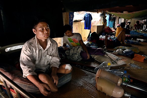 A soldier from the Myanmar rebel group, the Karen National Liberation Army, recovers from a double amputation in a secret hospital in Thailand. 
