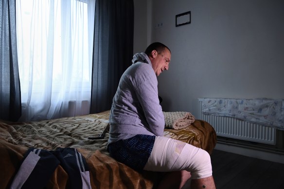 Dmytro Sylov, 33, shows his bandaged wounds sustained in a missile strike on November 9 in Lyman. Dmytro, a butcher, was about to carve up a pig at a house when the missile hit. 