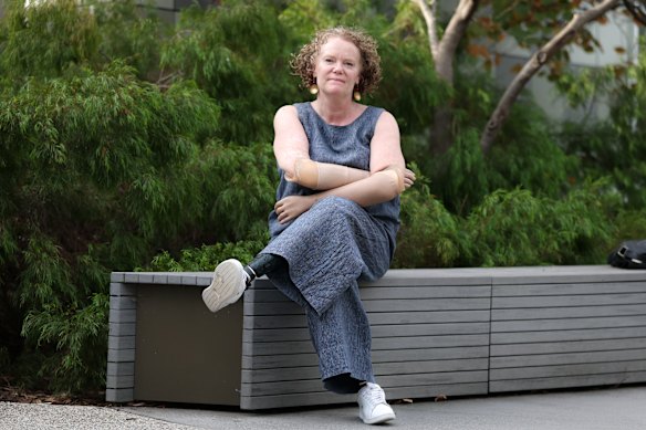 Kilmore East resident Mandy McCracken says health services are difficult to access for her community. 