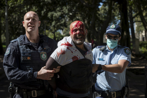 A man is seen bleeding from a head wound incurred during a dramatic arrest in Hyde Park.