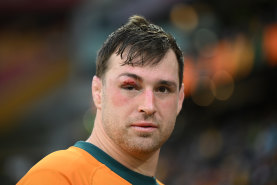 Nick Frost sports a black eye after the Wallabies’ heavy defeat.