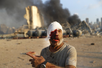 An injured man walks at the explosion scene that hit the seaport, in Beirut.