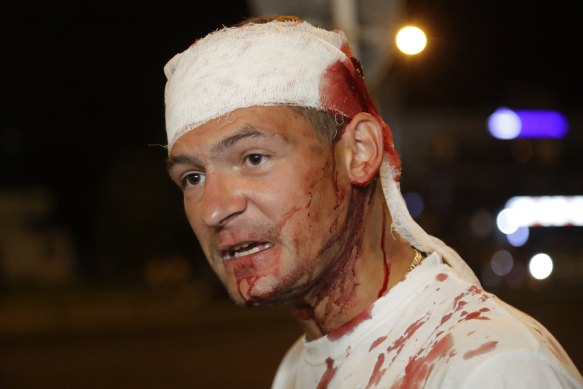 This man was wounded during clashes with police in Minsk.