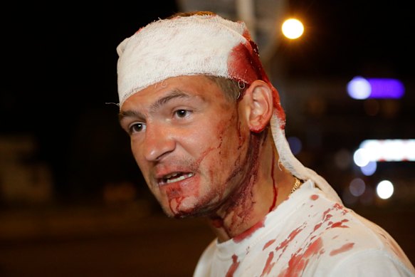 This man was wounded during clashes with police in Minsk.