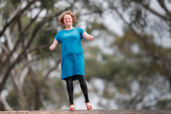 Mandy McCracken lost her hands and feet to sepsis in 2013.