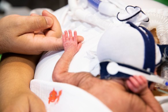Baby Gianna will spend Christmas Day in hospital at Sydney’s Royal North Shore Hospital.