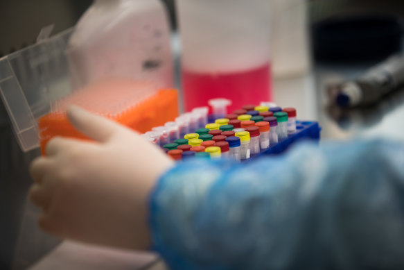 Swabs are tested for coronavirus at University Hospital Geelong.