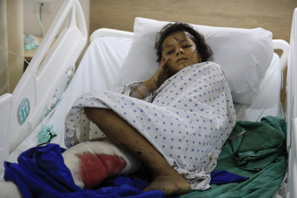 A wounded girl lies in a hospital bed in the southern village of Saksakieh, Lebanon.