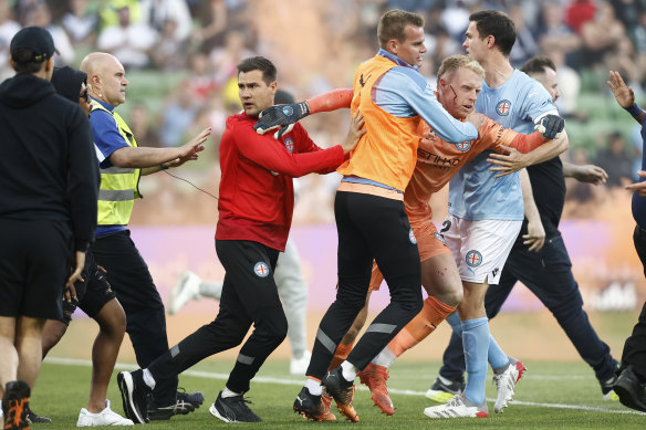 A bloodied Tom Glover is escorted from the pitch by teammates. 