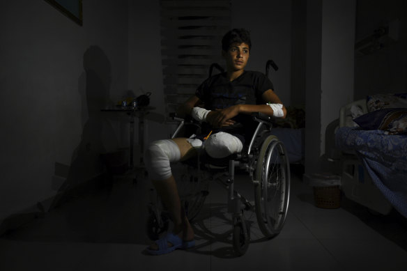 Ayham Yousef, 16, pictured in a Qamishli hospital, lost his leg following a Turkish airstrike.