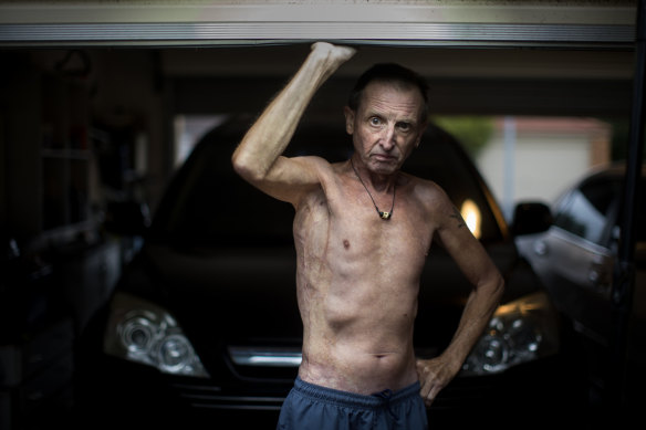 Former jockey Ron Lockett was “accidentally” set on fire as an apprentice in the 1970s.