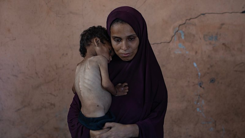 Starvation in Gaza is despicable and must be a turning point in this hideous war