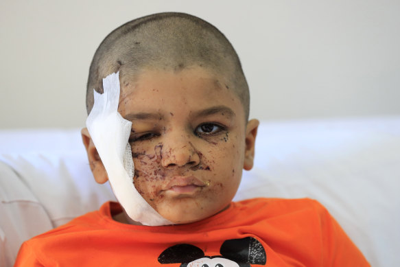 Ali Abdel Rahman Zorout, 5, who was wounded in an Israeli airstrike, poses at the Alaaeddine Hospital in Sarafand, south Lebanon.