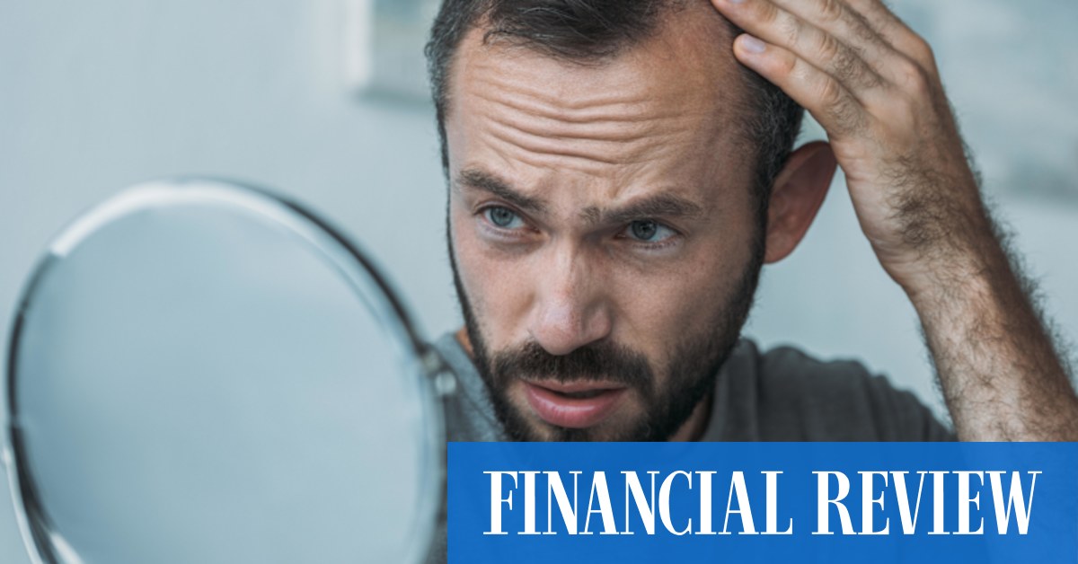 Hair loss treatment: Low dose minoxidil pills work, doctors say - Vimarsana News