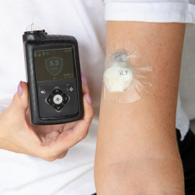 Diabetes medical staff are struggling to keep up with an explosion in people seeking wearable diabetes glucose monitoring and insulin pumps.