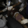 Palestinian medics treat a wounded child in Rafah, Gaza Strip on Saturday.