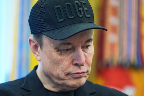 Musk sports a bruised eye which he said resulted from a play-fight with his young son, X.