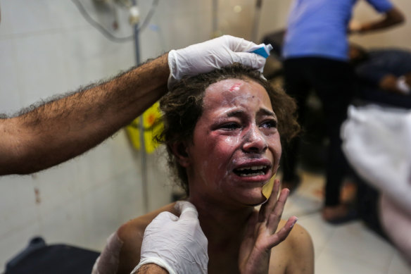 A Palestinian child at Nasser Medical Hospital after Israeli airstrikes on Tuesday.