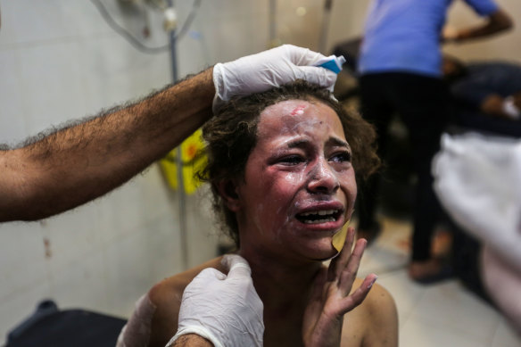 A Palestinian child receives treatment after Israeli air raids at Nasser Medical Hospital in Khan Yunis, southern Gaza, on Tuesday. 