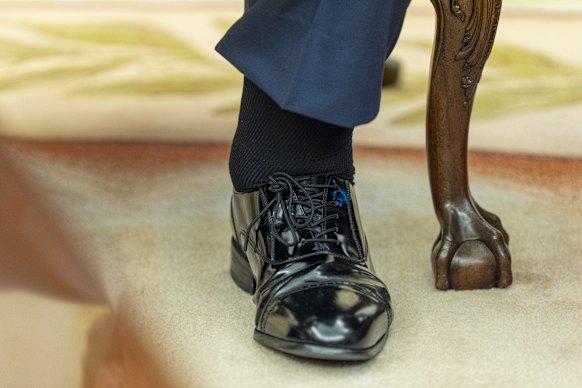 President Donald Trump’s swollen ankle seen in the Oval Office this week.