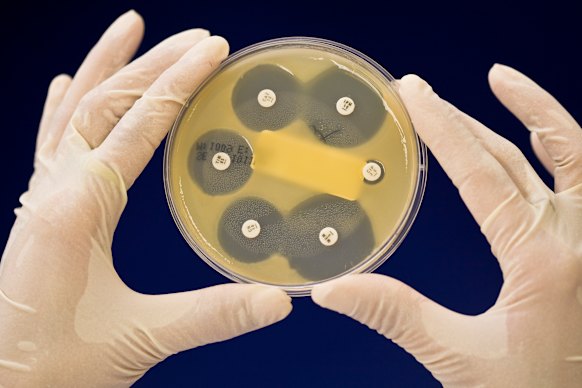 Medical research institutes are grappling with significant cuts to their research grants as a result of US changes. 