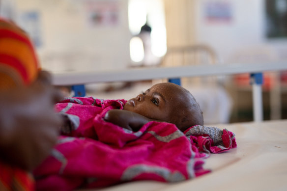 Amira Jimale 17 aylık ve Somaliland'daki Burao General Hospital'da yetersiz beslenme tedavisi görüyor.