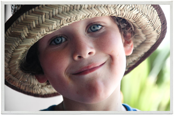 Lewis Jones the year after he was stung by a box jellyfish.