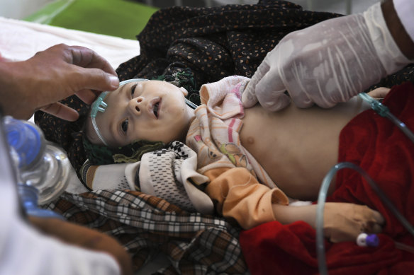 Medical staff at the Mofleh Pediatric Hospital perform CPR on three month old Safiullah in an attempt to save his life.