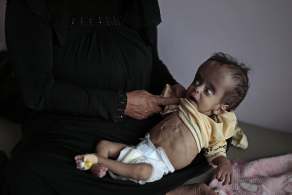 A woman holds her malnourished boy at a feeding centre at Al-Sabeen hospital in Sanaa, Yemen, in June.