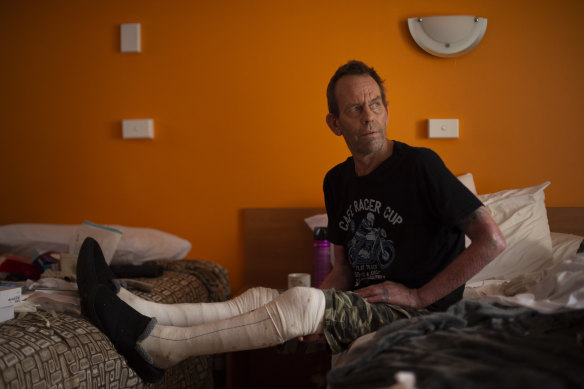 Roy Annesley in his western Sydney motel until he can return home to Yarranbella after suffering severe burns in a bushfire that destroyed his home.