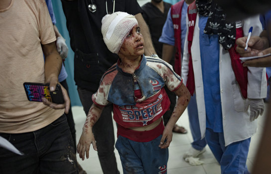 A Palestinian child, wounded in the Israeli bombardment of Gaza Strip, is brought to a hospital in Khan Younis on October 21, two weeks after the October 7 Hamas attacks on Israel.