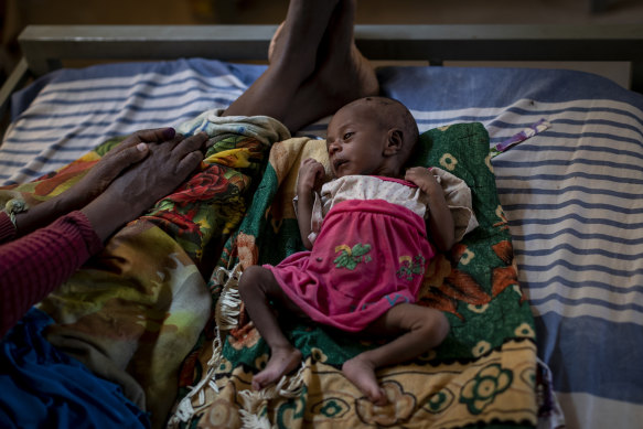 Tigsti Mahderekal, 20 days old, was carried by her mother for 12 days to a medical clinic in Abi Adi, in search of food and medicine. 