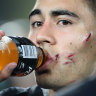 Shaun Johnson sporting the scars of his debut Test, age 22, against the Kangaroos in 2012.