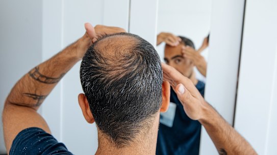 Some hair loss treatments have been linked to lower sperm counts.