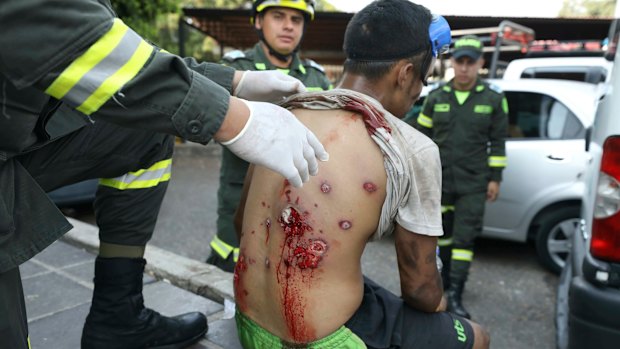 A youth's back is inspected by a medic after he was injured during clashes with Venezuelan National Guardsmen on the Simon Bolivar International Bridge in La Parada, Colombia, on Monday.