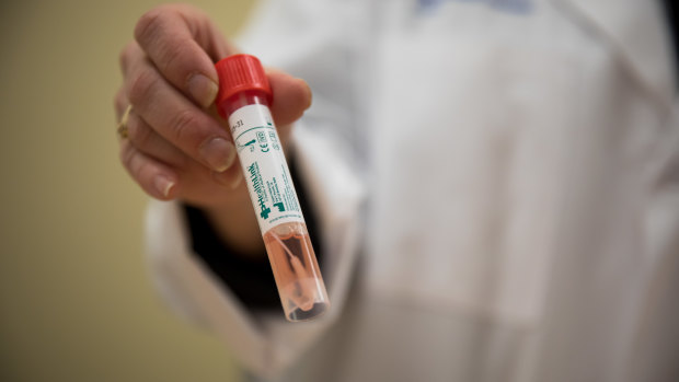 The CDC is limiting California to just eight to 10 test cases a week.