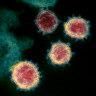 The coronavirus that causes COVID-19.