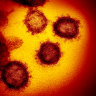 Australian tourist who died in Iceland tested positive for coronavirus