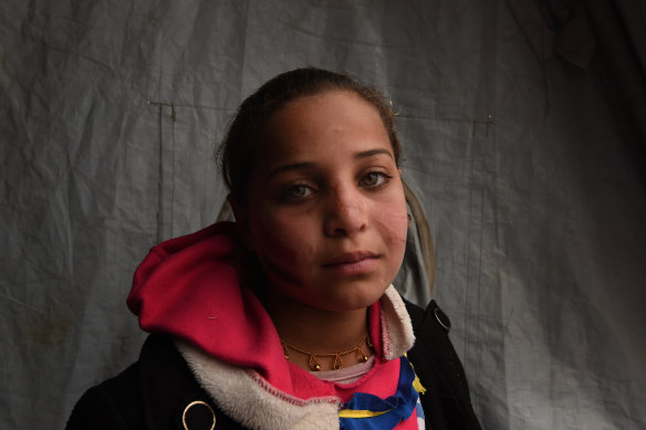 Ten-year-old Sabeen, from Mosul at Qayyarah camp in northern Iraq in 2017. She was on her way to school when a car bomb killed her brother and injured her leaving scars on her face.